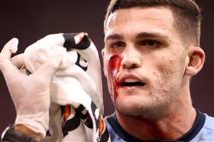 TOWNSVILLE, AUSTRALIA - JUNE 09: Nathan Cleary of the Blues is attended to by a team trainer after a cut to his face during game one of the 2021 State of Origin series between the New South Wales Blues and the Queensland Maroons at Queensland Country Bank Stadium on June 09, 2021 in Townsville, Australia. (Photo by Mark Kolbe/Getty Images)