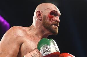 LAS VEGAS, NEVADA - SEPTEMBER 14: Tyson Fury during his heavyweight bout against Otto Wallin at T-Mobile Arena on September 14, 2019 in Las Vegas, Nevada. Tyson won by an unanimous decision after the 12-round bout. (Getty Images)